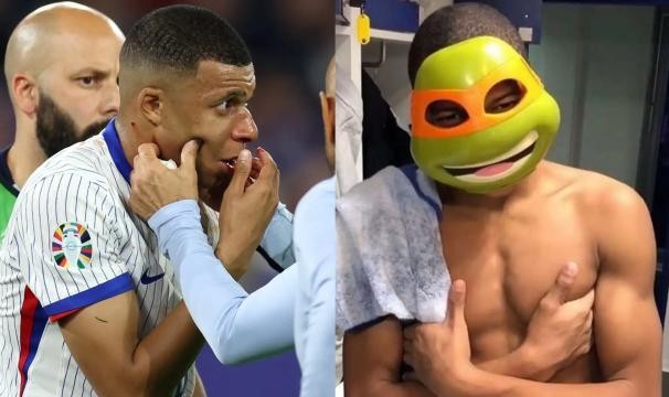 开云网页登录-【盘点】断鼻姆巴佩将解锁新皮肤，细数足坛“面具侠”